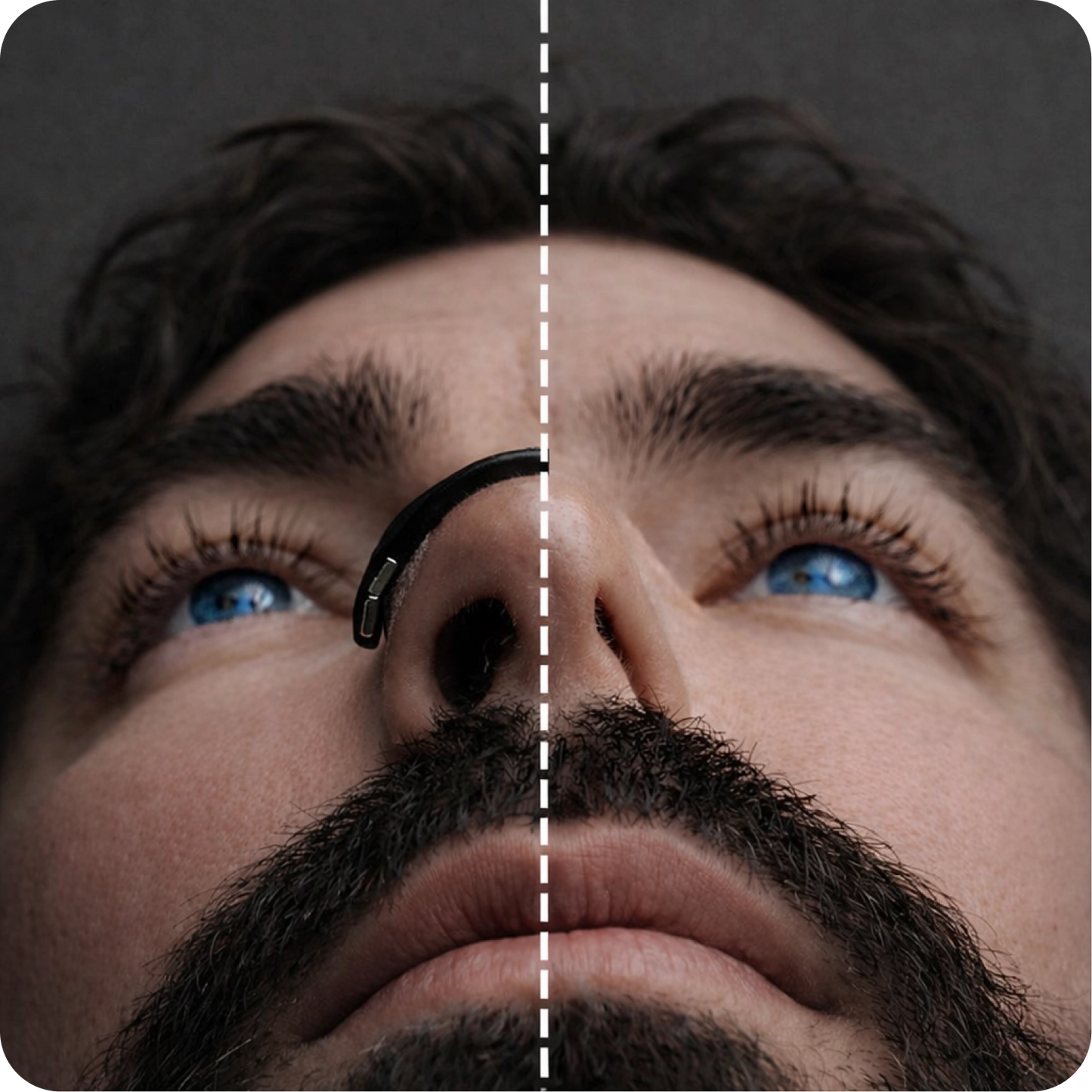 Performance Boosting Nasal Dilator Kit